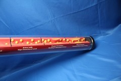 Edco Health Education Silent Destruction: How High Cholesterol Destroys Arteries
