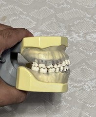 KM-C-210 Articulated Periodontal Soft Clear Gingival Typodont Model