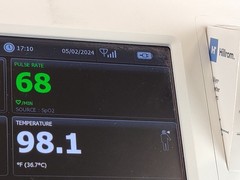 Welch Allyn Connex Vital Sign Monitor 6000 WIFI EMR Conn 65NTXX with Accessories