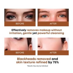 SOMISOME Rice Water Cleansing Pads – Makeup Remover 50 Count (Pack of 1)
