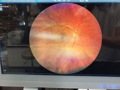 Zeiss Clarus 500 Ultra Wide Field Fundus Camera 200° UWF 2019