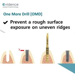 Evidence Implant One More Drill [OMD]