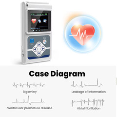 CONTEC TLC9803 3Channel Dynamic ECG Holter 24Hour Monitor US Fast Local Delivery