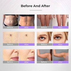 9 in 1 Beauty Machine for Skin Smoothing & Enhance Body Curves Vertical Model