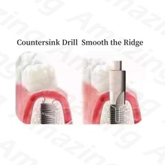 5.2MM Dental Countersink Drill Profiler Remover Smooth Ridge Trimmer Drills