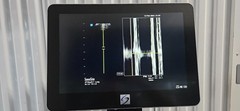 SonoSite X-Porte Ultrasound