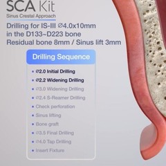 Implant Crestal Approach Sinus Surgical Drill Neobiotech SCA 3S Membrane Lifter