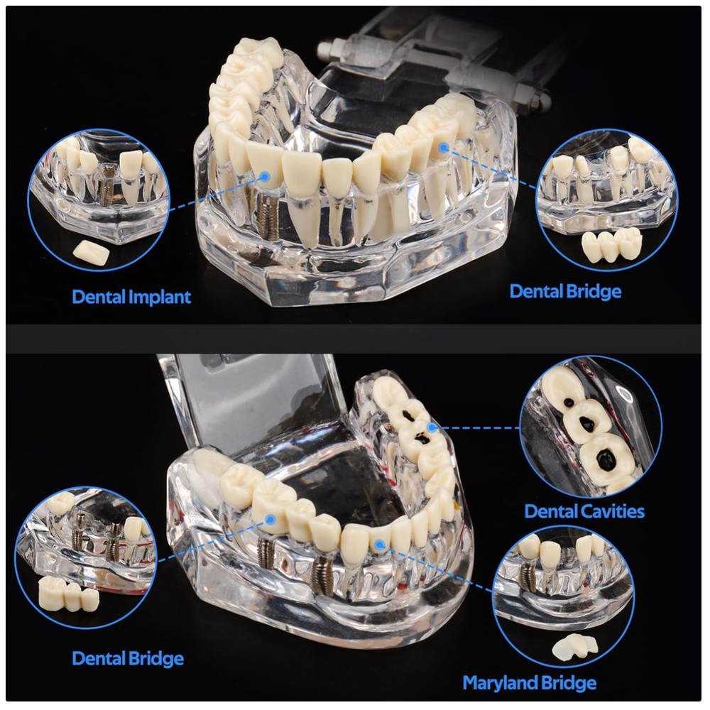 Dental Teaching Tool with Removable Teeth