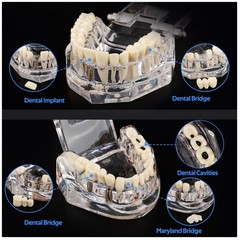 Dental Teaching Tool with Removable Teeth