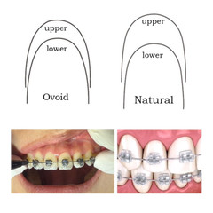 100pcs Dental Orthodontic Arch Wire Super Elastic NiTi Ovoid Natural Form Round