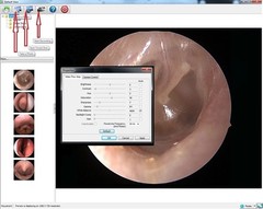 Rigid Endoscope Cystoscope Arthroscope HD USB Camera Head+Coupler+Light Source