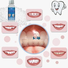 Fake Teeth Repair Kit, Provisional Fake Teeth Kit for Provisional Restoration…