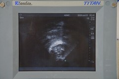 SonoSite Titan High-Resolution Imaging System W/ C15/4-2 MHz & Cart