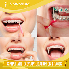 Latex Elastics Rubber Bands Orthodontic Dental Braces Teeth – Light Medium Heavy