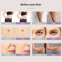 6 in 1 Beauty Machine Body Silhouette Enhancing Massager Improve Skin Firmness