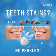 MySmile Teeth Whitening Kit with LED Light, 10 Min 3 Fl Oz (Pack of 3)
