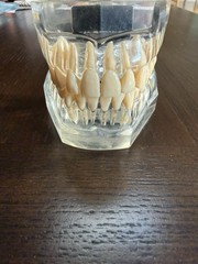 Dental Typodont Model