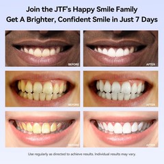 JTF Teeth Whitening Pen Kit: 35% Carbamide 0.07 Ounce (Pack of 6), White