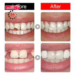 168 Pieces False Teeth Dental Complete Acrylic Resin Denture Teeth, 6 Sets…