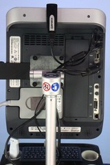 SonoSite S-ICU Portable Ultrasound with Stand, Transducer & Printer Tested
