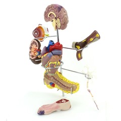 Medical Anatomical Human Diabetes Model 8 Parts Shows The Harm Of Diabetes