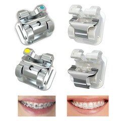 Orthodontic Self-ligating Brackets Ceramic Metal Braces Empower Clear Roth MBT
