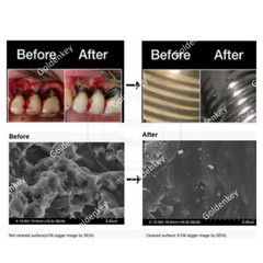Dental Titanium Brush Peri-implantitis Surface Cleaning Brush Bristles Tool USA