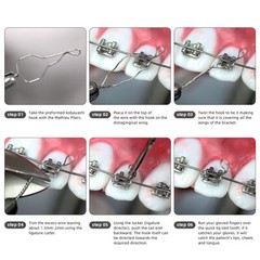 Dental Orthodontic Wire Preformed Kobayashi Ligature Ties Long Short Twist Wires