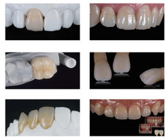 C14 Glass Ceramic Blocks HT LT Lithium Disilicate CAD/CAM Cerec Blocks 5Pcs/Box