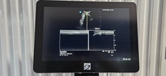 SonoSite X-Porte Ultrasound