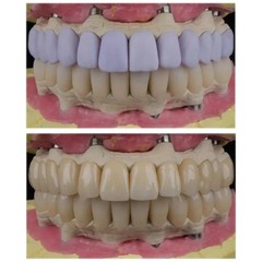 US C14 Emax Dental Glass Ceramic HT LT Lithium Dislicate CAD/CAM Cerec Blocks