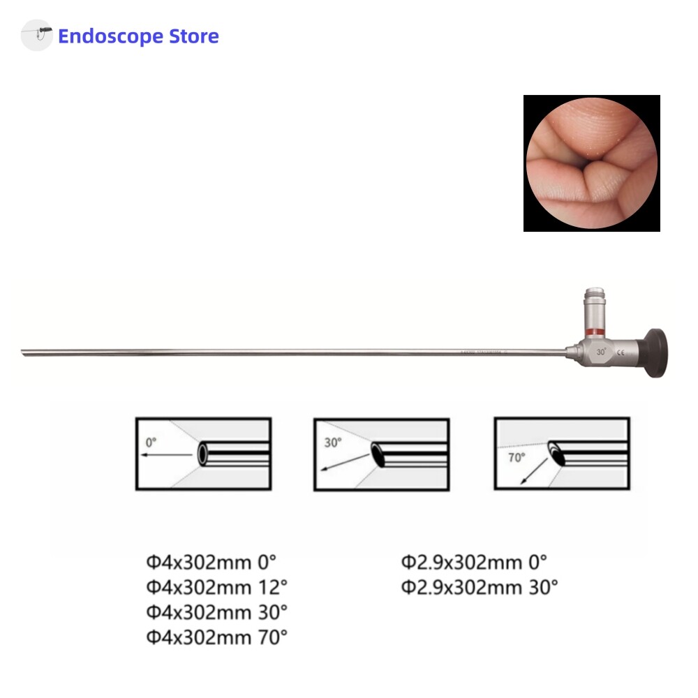 HD Medical Surgical Φ2.9mm Φ4mm 302mm 0° 12° 30° 70° Rigid Endoscope Optics