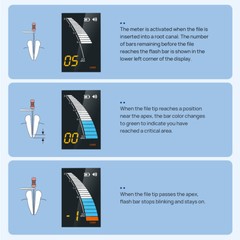 AZDENT Dental Cordless LED 16:1 Endo Motor / Apex Locator Root Canal Finder