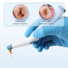 Dental Endo Ultrasonic Sonic Activator Root Canal Irrigator w/ scaling file