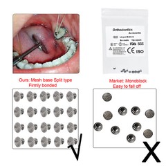 50 Pcs Dental Orthodontic Bondable Metal Lingual Buttons Round Mesh Base Split