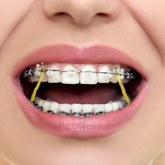 100Pcs/Bag JMU Dental Orthodontic Intra Oral Elastic Latex Rubber Bands 13 Sizes