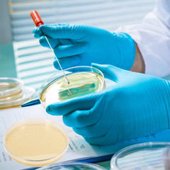 Potato Dextrose Agar Petri Dishes – Prepoured Potato Dextrose Agar (PDA) – for M