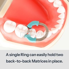 Dental Autoclavable separator rings Bands Matrices Clip Ni-Titanium Fit V3 ring