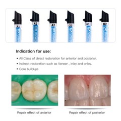 Dental Light Cure Resin Dentin Enamel / Visible Adhesive/ 37% Acid Etching Gel