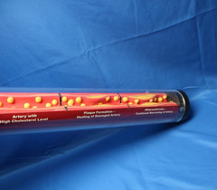Edco Health Education Silent Destruction: How High Cholesterol Destroys Arteries