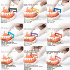 EASYINSMILE 10Pcs/Pk Orthodontic IPR Strip Reusable Strips Reduction Kit System
