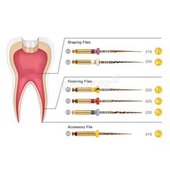 AZDENT Dental Endo Rotary Files Gold Taper NITI Endodontic Root Files SX-F3 25MM