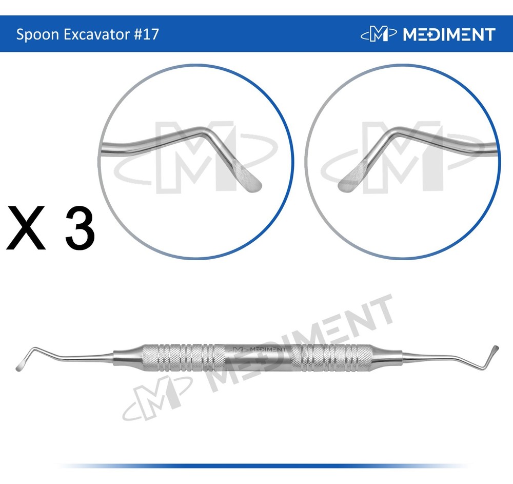 X3 DENTAL PERIODONTAL INSTRUMENT SPOON EXCAVATOR # 17 8MM HOLLOW GRIP STAINLESS