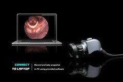 Endoscopy Camera & Cold LED Light Source HD USB ENT Medical Endoscope with fiber