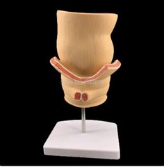Anatomical Human Rectum Pathology Lesion Model Hemorrhoids Anus Teaching Supply