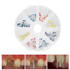 Glass Fiber Post Dental Fiber Post teeth Restorative 1.0/1.2/1.4/1.6/1.8mm