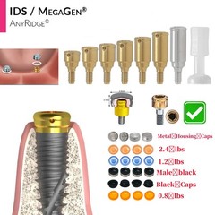 Dental Zest Locator Overdenture Attachment System Compatible Multiple Implant