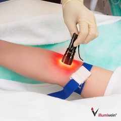 Vein Finder New Model Registered