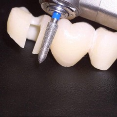 Zirconia, Lithium Disilicate & E-Max Gingival Curettage 878K / 021PF 6/PK
