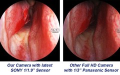 Endoscopy Camera Full Hd Laparoscopic Endoscope ENT 1080p Medical Storz Olympus